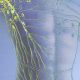 How do Scars Affect the Lymphatic System